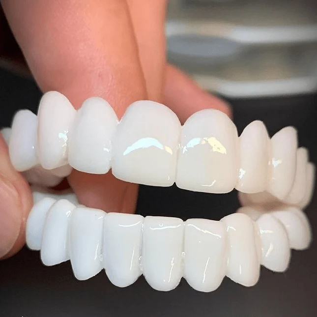 Euroselle Aesthetic Reusable Dentures With White Dental Lenses For Natural-Looking Confident Smile